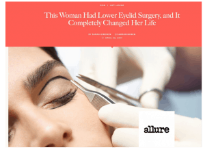 eyelid-surgery