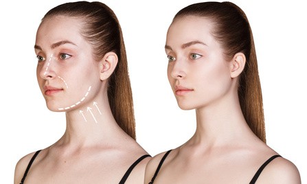 What to Expect Before and After a Facelift