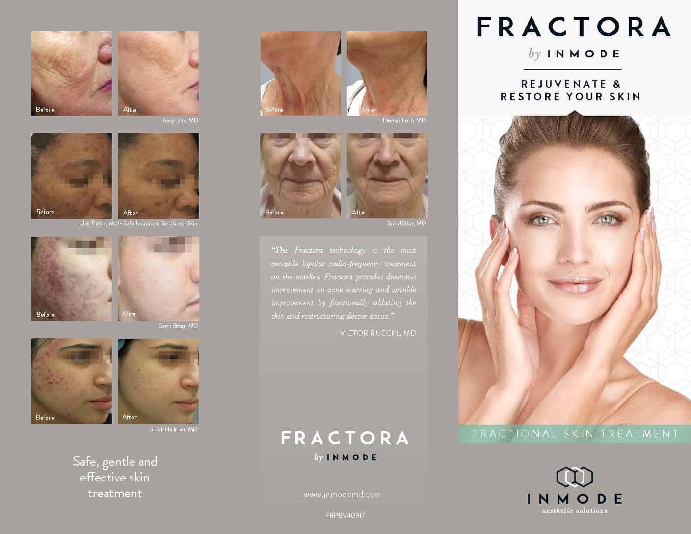 How Much Does Forma Skin Tightening Cost